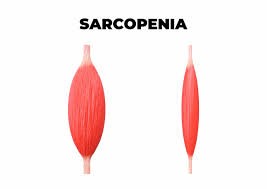 APA ITU SARCOPENIA?